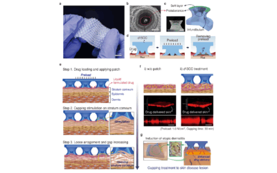 Octopus Sucker-Inspired Patches: An Innovative Technology for Transdermal Drug Delivery through the Stratum Corneum