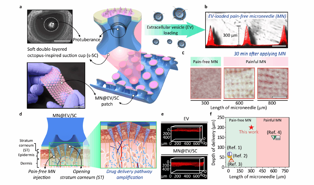 Pain-Free Transdermal Delivery of Extracellular Vesicles via a Hierarchical Microneedle-Cupping Dual-Amplified Patch