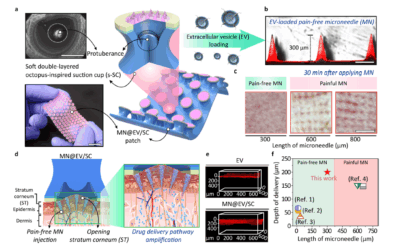 Pain-Free Transdermal Delivery of Extracellular Vesicles via a Hierarchical Microneedle-Cupping Dual-Amplified Patch