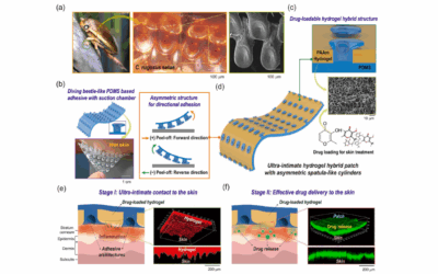 Bio-Adhesive Hydrogel Patch with Beetle-Wing Structure for Atopic Dermatitis Treatment