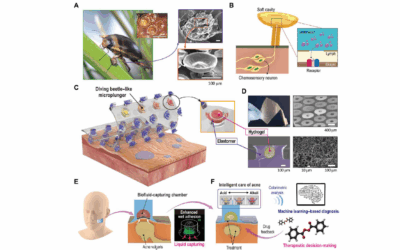 Smart Technology for Diagnosing Skin Diseases with a Beetle-Inspired Flexible Patch